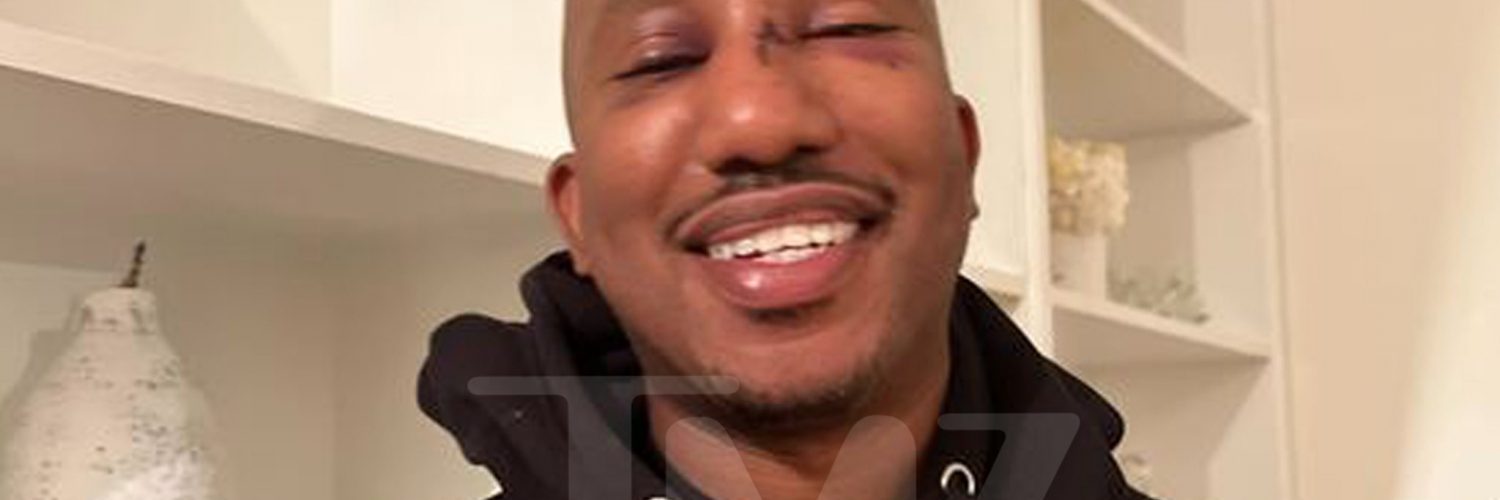 ‘SNL’ Star Chris Redd Injury Photos From Brutal Attack