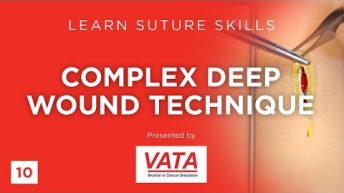 Complex Deep Wound Technique – Learn Suture Skills – VATA