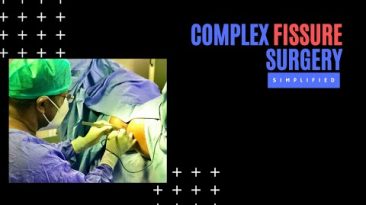 Complex Fissure Surgery Simplified