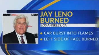 Jay Leno suffers serious burns in car fire, TMZ reports