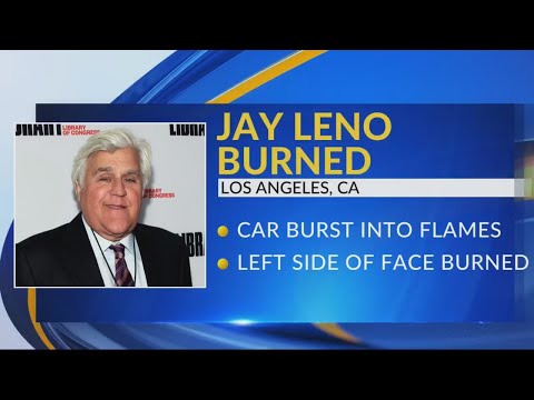 Jay Leno suffers serious burns in car fire, TMZ reports