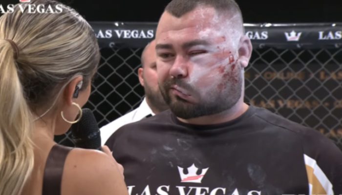 VIDEO | Slap fighter Sorin Comsa left disfigured after ten rounds of open-handed carnage at RXF Slap Fighting Championships