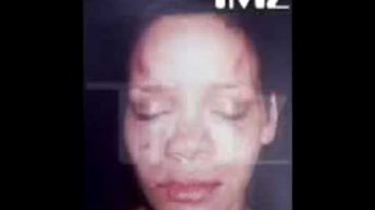 BREAKING NEWS: Rihanna bruised and beaten photos Leaked. TMZ