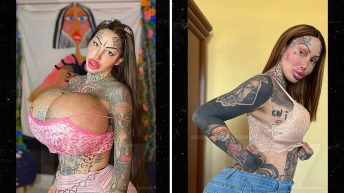 Instagram Model Loses 20 Lbs. from Breast Reduction After 38J Implant Bursts