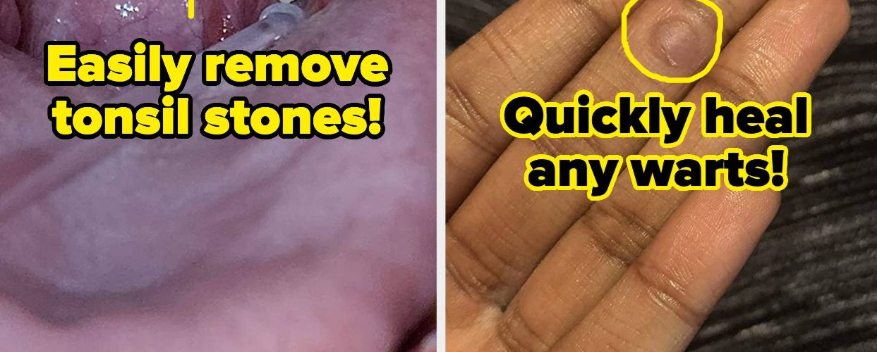 Try These 38 Products For Any Cringe-Worthy Problems That Arise