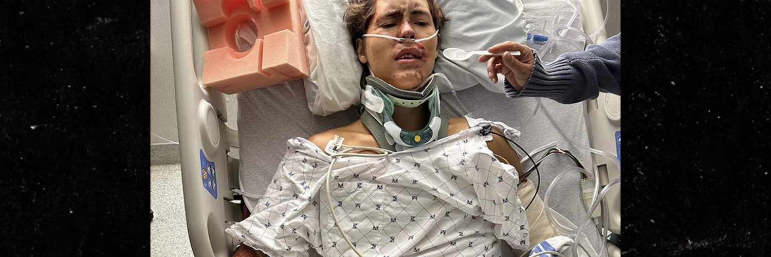 TikTok Star Caleb Coffee Fractures Spine After Fall Off Cliff Onto Lava Rock