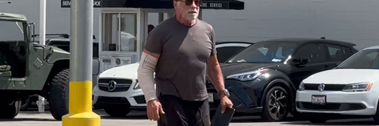 Arnold Schwarzenegger Sporting Arm Cast After Undergoing Elbow Surgery