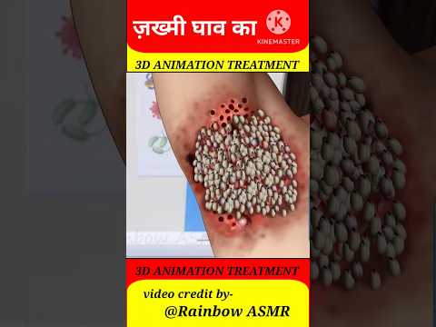 ज़ख्मी घाव का |3D ANIMATION TREATMENT #shots #viral #trending #asmr #yotubeshorts@MrBeast