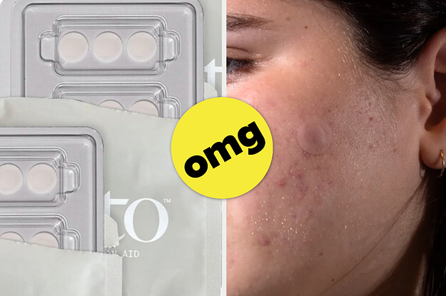 These Prickly Patches Will Pop Pesky Pimples Before They Form Breakouts