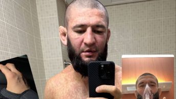 UFC star Khamzat Chimaev shares photos of recent health scare: “I was very sick”