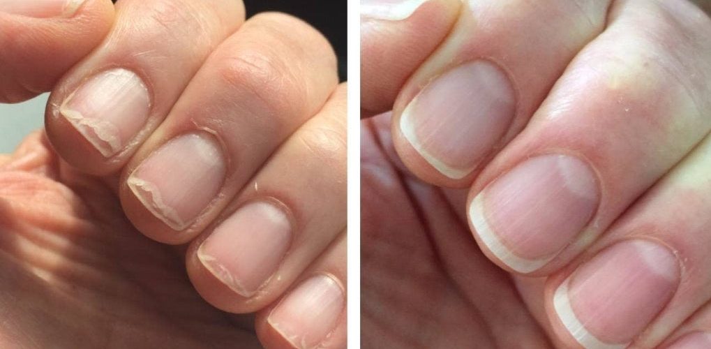 34 Really Satisfying Before And Afters For Anyone Who Just Wants To Feel Something