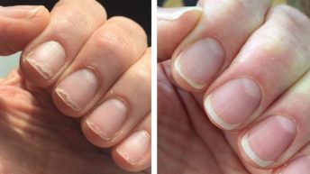 34 Really Satisfying Before And Afters For Anyone Who Just Wants To Feel Something