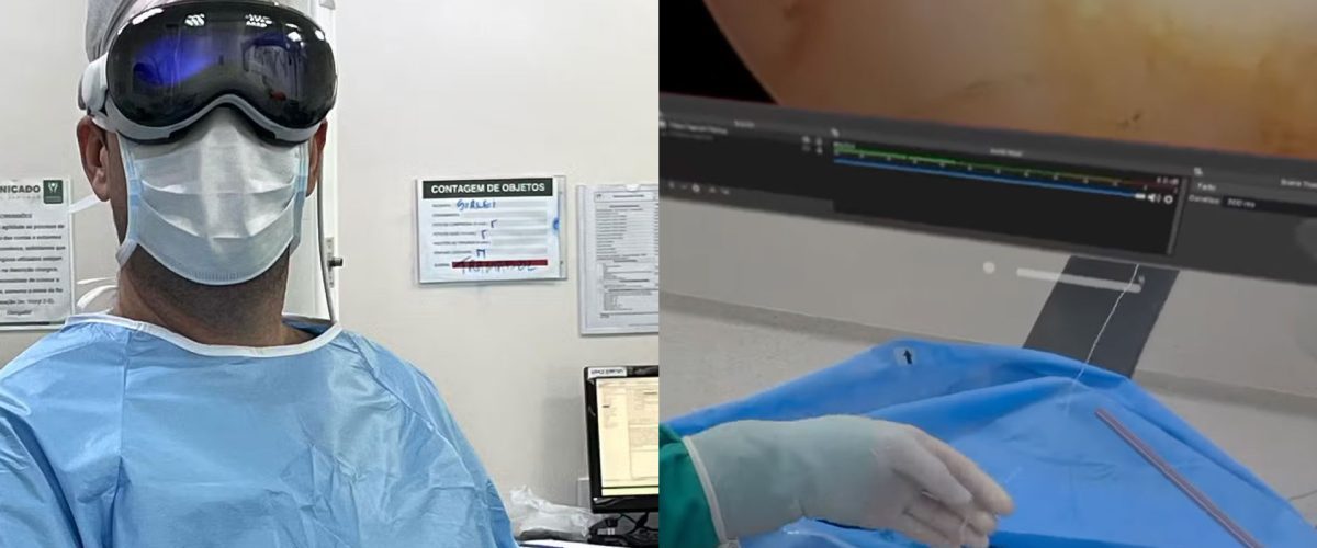 Apple Vision Pro used to assist doctor during shoulder arthroscopy surgery in Brazil