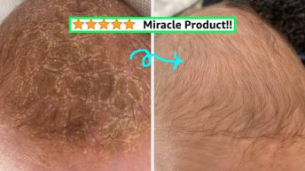 Proceed With Caution, These 30 Products Have Before And After Pics That’ll Shake You Like A Polaroid Picture