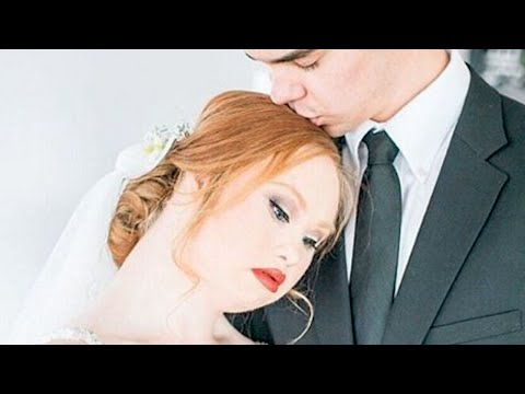 This Model with Down Syndrome’s Bridal Photos are GORGEOUS | What’s Trending Now