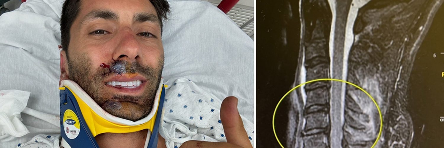 Nev Schulman Breaks Neck in Bike Accident