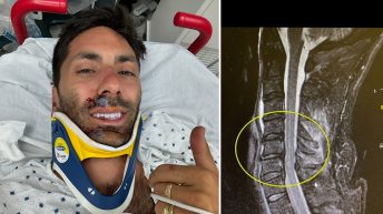 Nev Schulman Breaks Neck in Bike Accident