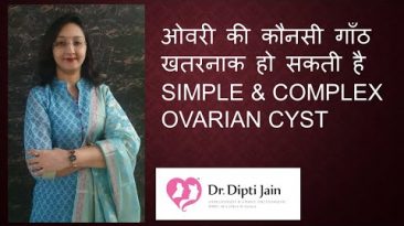 OVARIAN CYST – SIMPLE & COMPLEX ओवरी की गाँठ Which one is dangerous ?