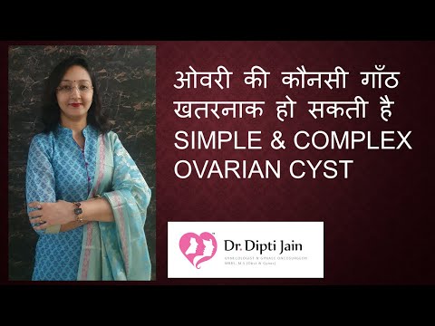 OVARIAN CYST – SIMPLE & COMPLEX ओवरी की गाँठ Which one is dangerous ?