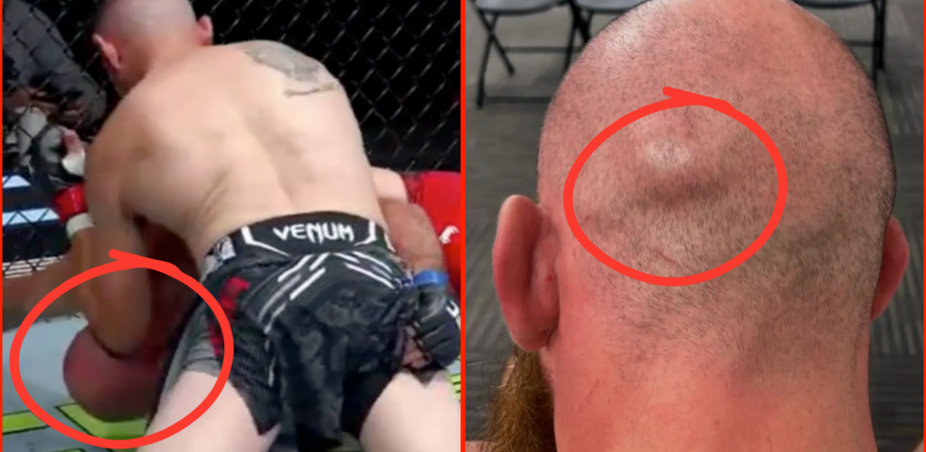 ‘This should be a no contest’… UFC fighter’s wife calls for first round KO loss to be overturned after ‘illegal elbow’