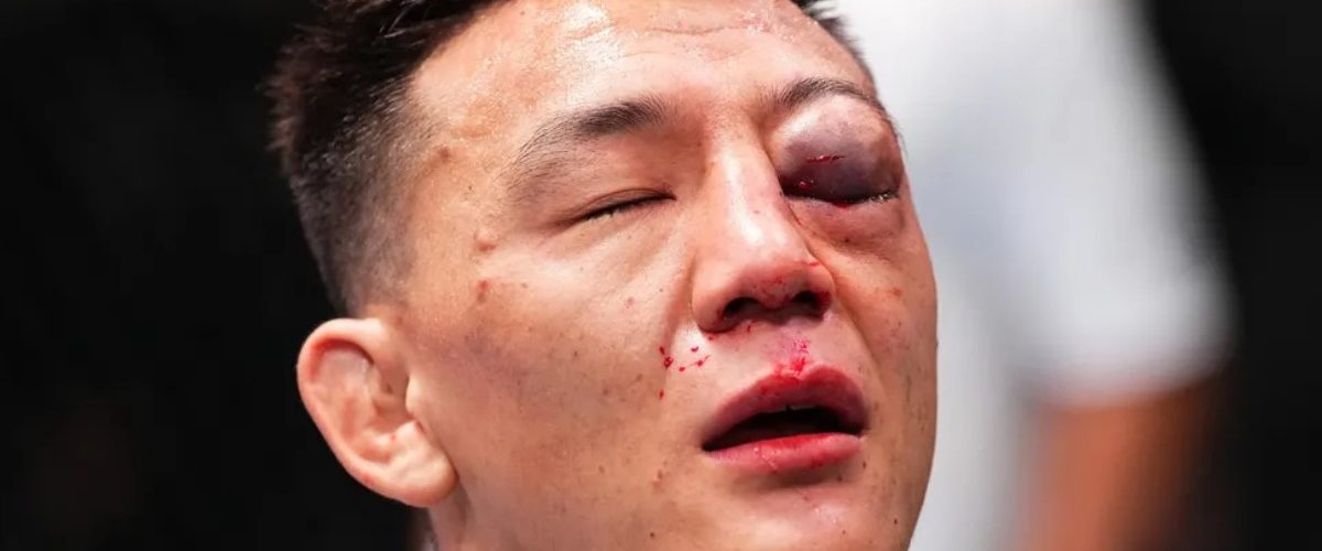 Rongzhu suffered multiple facial fractures in TKO loss to Chris Padilla at UFC Vegas 97